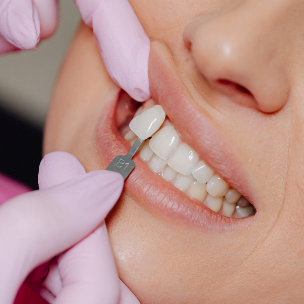 best dental clinic for smile designing in hyderabad