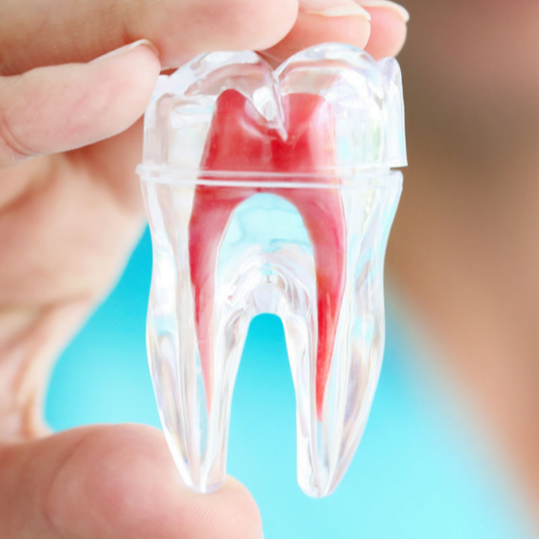 1 Best Dental Clinic for Root Canal Treatment in Hyderabad