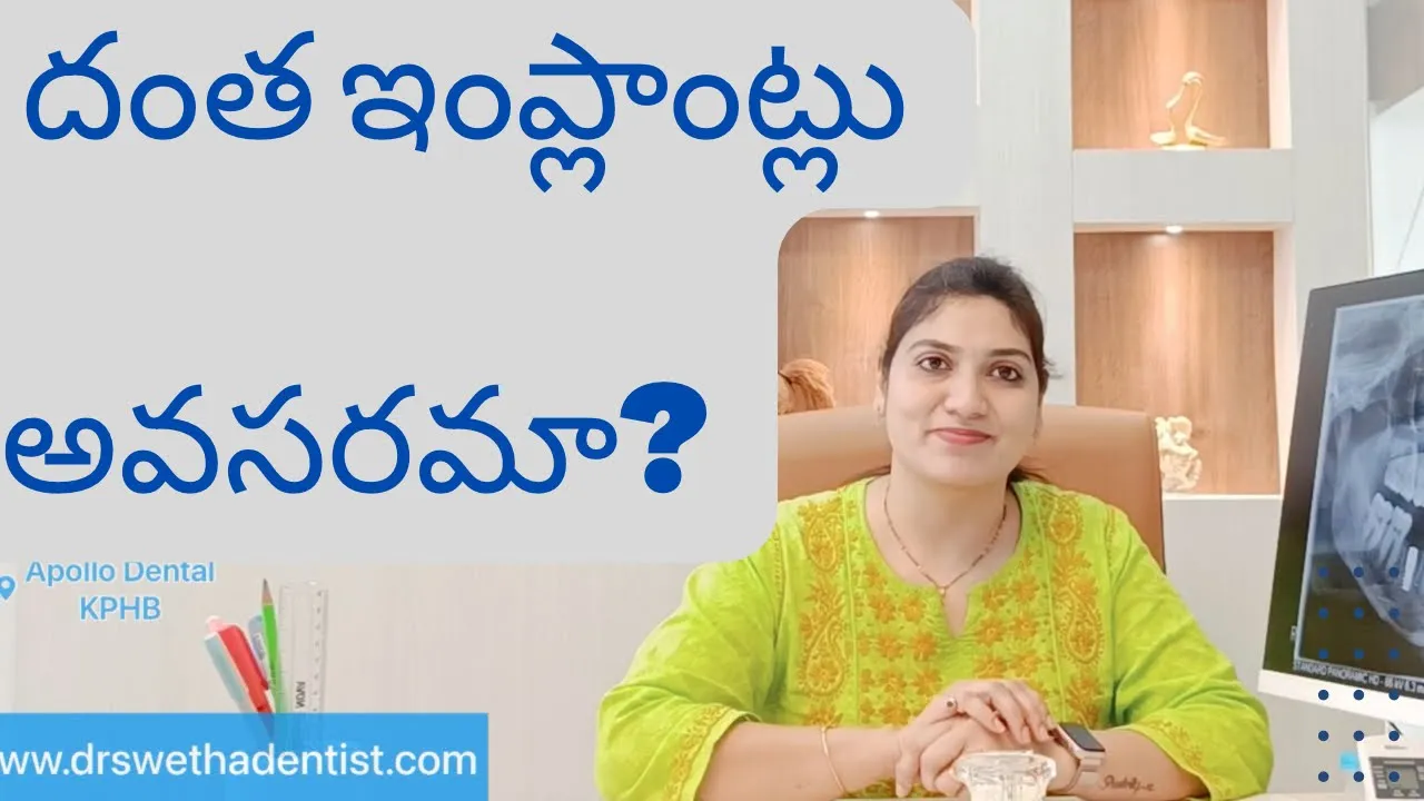 డెంటల్ ఇంప్లాంట్స్ అవసరమా? What are Dental Implants? Dr Swetha 3 డెంటల్ ఇంప్లాంట్స్ అవసరమా? What are Dental Implants? Dr Swetha