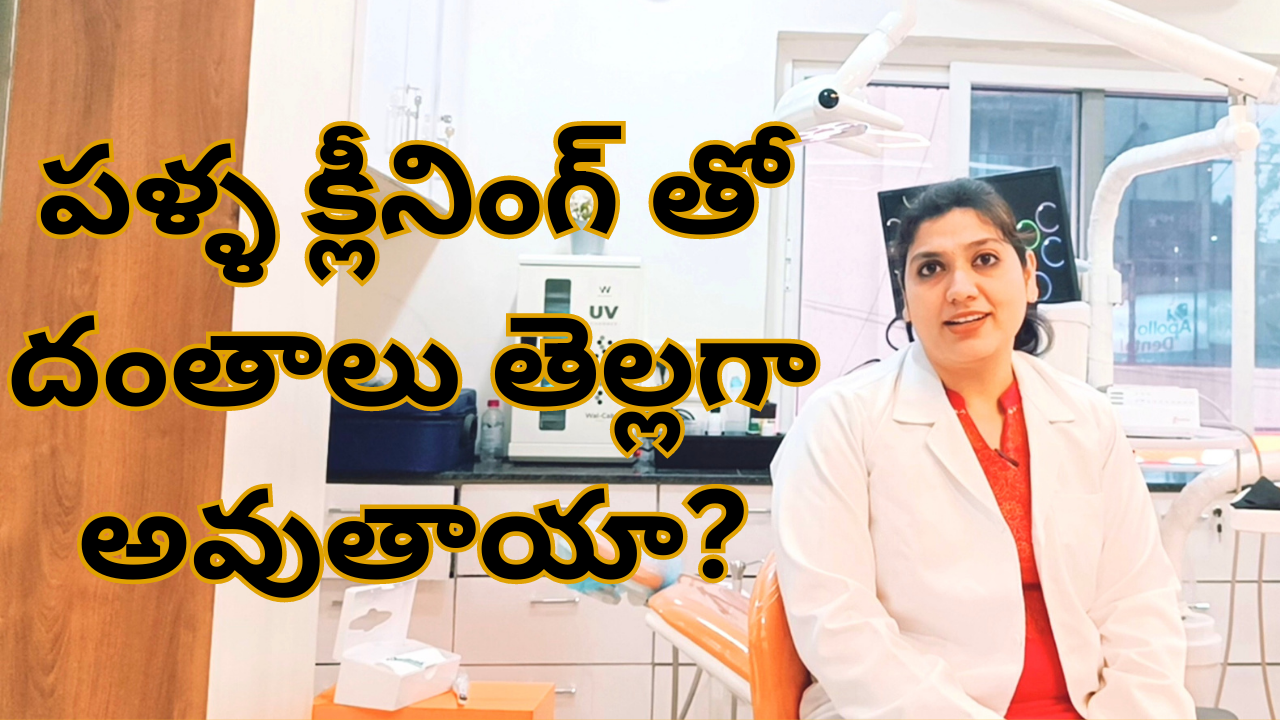 Does Teeth Cleaning make Teeth Whiter? In Telugu by Dr Swetha 3 Does Teeth Cleaning make Teeth Whiter? In Telugu by Dr Swetha