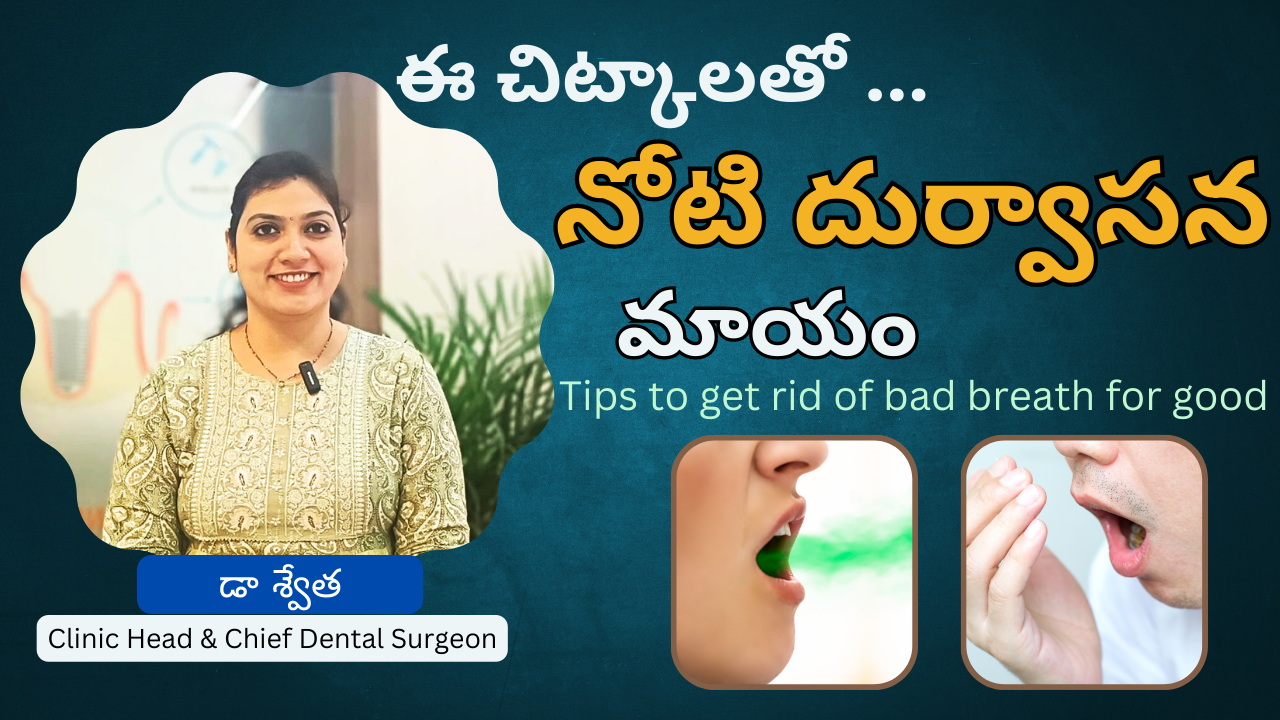 నోటి దుర్వాసన పోవాలా ? 7 Best Tips to Get Rid of Bad Breath for Good in Telugu | Dr Swetha | Hyderabad 9 నోటి దుర్వాసన పోవాలా ? 7 Best Tips to Get Rid of Bad Breath for Good in Telugu | Dr Swetha | Hyderabad