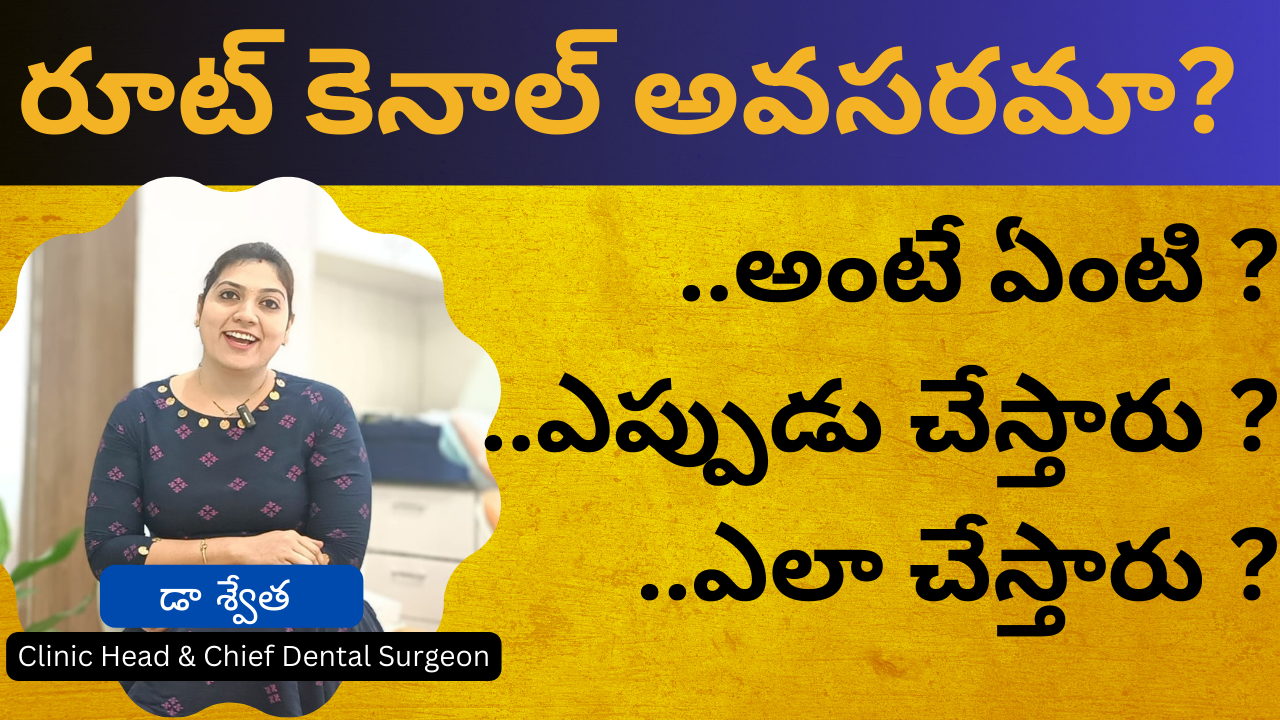 రూట్ కెనాల్ ఎప్పుడు చేస్తారు? చేసే విధానం ఏంటి? Best Root Canal Treatment in Telugu | Dr Swetha | Hyderabad 3 రూట్ కెనాల్ ఎప్పుడు చేస్తారు? చేసే విధానం ఏంటి? Best Root Canal Treatment in Telugu | Dr Swetha | Hyderabad