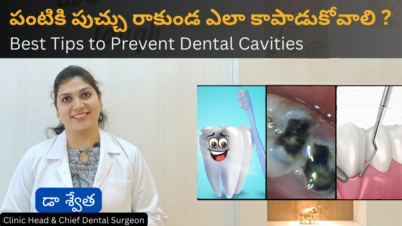 దంతాల పుచ్చు రాకుండా నిరోధించడానికి ఉత్తమ చిట్కాలు | Best Tips to Prevent Teeth Cavities 1 దంతాల పుచ్చు రాకుండా నిరోధించడానికి ఉత్తమ చిట్కాలు | Best Tips to Prevent Teeth Cavities