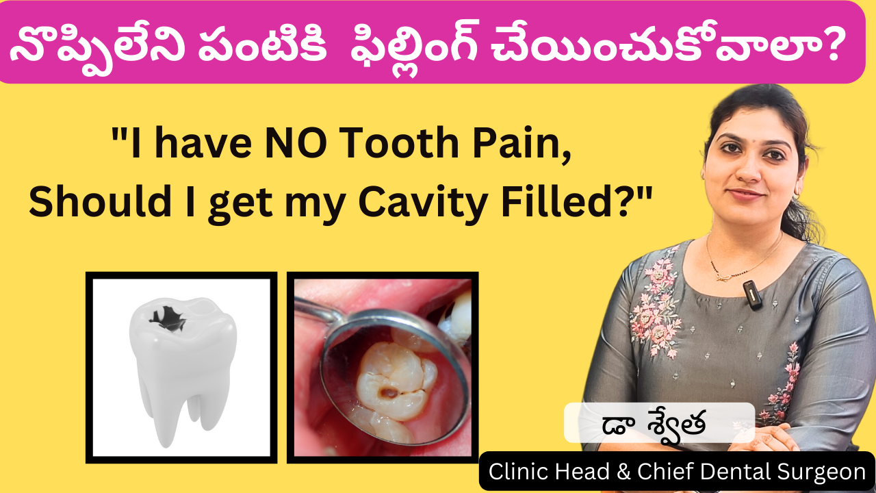Should you get your cavity filled even when there is no Pain? Dr. Swetha, Dentist | Kukatpally, Manikonda & Kondapur | Hyderabad 1 Should you get your cavity filled even when there is no Pain? Dr. Swetha, Dentist | Kukatpally, Manikonda & Kondapur | Hyderabad