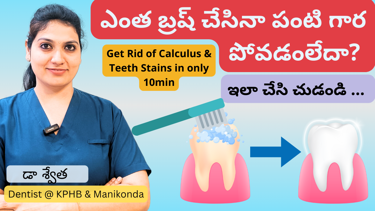 Why Teeth Cleaning is Needed? | Teeth Scaling | Bleeding Gums | Dental Cleaning | in Telugu | Dr Swetha | Dentist @ KPHB & Manikonda