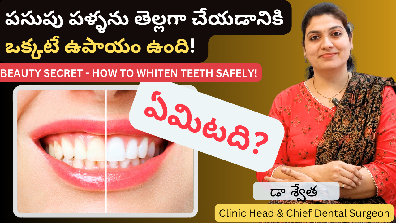 Best Teeth Whitening Solution in Telugu | పసుపు పళ్లు తెల్లగా ఎలా?| Dr Swetha | Dentist @ KPHB, Kondapur & Manikonda 2 Best Teeth Whitening Solution in Telugu | పసుపు పళ్లు తెల్లగా ఎలా?| Dr Swetha | Dentist @ KPHB, Kondapur & Manikonda