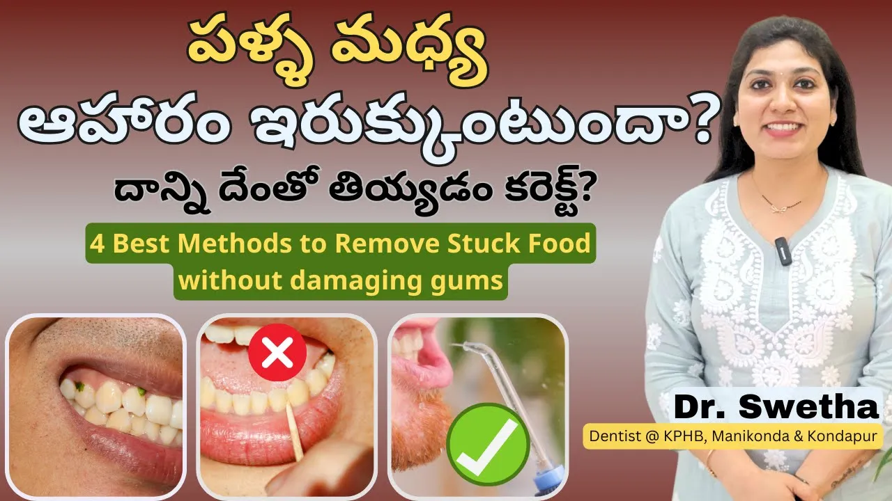 4 Ways to Safely Remove Stuck Food | పళ్ల మధ్య ఇరుక్కున్న ఆహారాన్ని దేంతో తియ్యాలి? Telugu 6 4 Ways to Safely Remove Stuck Food | పళ్ల మధ్య ఇరుక్కున్న ఆహారాన్ని దేంతో తియ్యాలి? Telugu