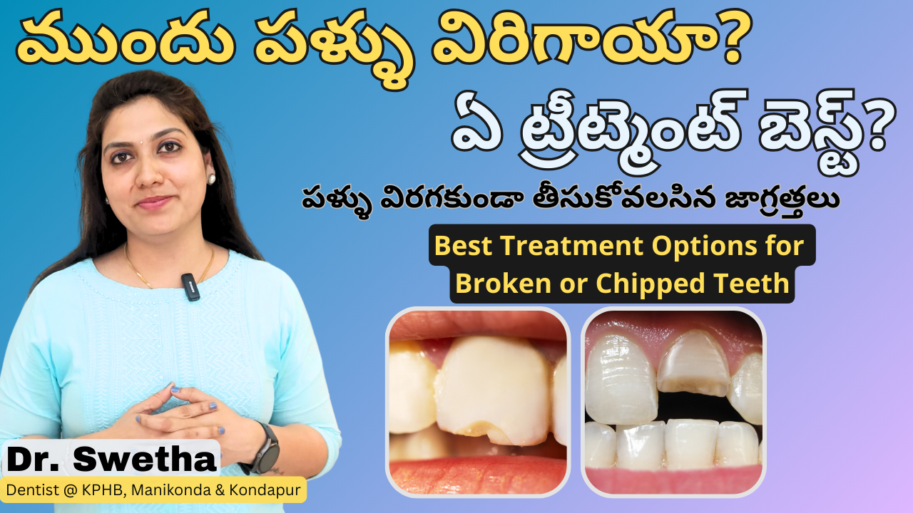 ముందు పళ్ళు విరిగాయా? Best Treatment Options for Broken Teeth or Fractured Teeth with Tips in Telugu | Dr Swetha | Dentist at Kukatpally-KPHB & Gachibowli-Kondapur 4 ముందు పళ్ళు విరిగాయా? Best Treatment Options for Broken Teeth or Fractured Teeth with Tips in Telugu | Dr Swetha | Dentist at Kukatpally-KPHB & Gachibowli-Kondapur