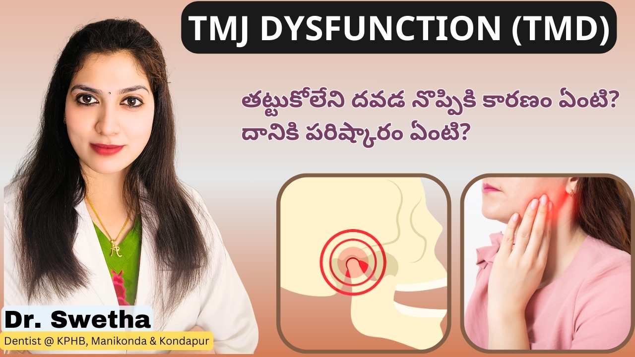 2 Best Treatment Options for TMJ (Temporomandibular Joint) Dysfunction or TMD | దవడ నొప్పి | Dr Swetha | Dentist at Kukatpally-KPHB, Manikonda & Gachibowli-Kondapur 2 2 Best Treatment Options for TMJ (Temporomandibular Joint) Dysfunction or TMD | దవడ నొప్పి | Dr Swetha | Dentist at Kukatpally-KPHB, Manikonda & Gachibowli-Kondapur